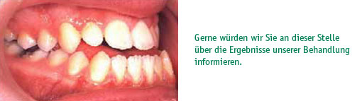 Gerne würden wir Sie an dieser Stelle über die Ergebnisse unserer Behandlungen informieren.</p><p>Das Heilmittelwerbegesetz (HWG) verbietet jedoch die Darstellung von Vorher-Nachher-Bildern bei medizinisch-indizierten Heilbehandlungen und seit dem 01.04.2006 auch bei operativen plastischchirurgischen Eingriffen, soweit sich die Werbeaussage auf die Veränderung des menschlichen Körpers ohne medizinische Notwendigkeit bezieht.</p><p>Wir bedauern diese Entscheidung des Gesetzgebers, da sie im Widerspruch zu dem sachlichen Informationsbedürfnis unserer Patienten steht.</p><p>Gerne informieren wir Sie in einem persönlichen Gespräch über unsere Behandlungsmethoden.