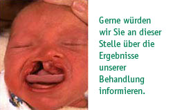 Gerne würden wir Sie an dieser Stelle über die Ergebnisse unserer Behandlungen informieren.</p><p>Das Heilmittelwerbegesetz (HWG) verbietet jedoch die Darstellung von Vorher-Nachher-Bildern bei medizinisch-indizierten Heilbehandlungen und seit dem 01.04.2006 auch bei operativen plastischchirurgischen Eingriffen, soweit sich die Werbeaussage auf die Veränderung des menschlichen Körpers ohne medizinische Notwendigkeit bezieht.</p><p>Wir bedauern diese Entscheidung des Gesetzgebers, da sie im Widerspruch zu dem sachlichen Informationsbedürfnis unserer Patienten steht.</p><p>Gerne informieren wir Sie in einem persönlichen Gespräch über unsere Behandlungsmethoden.
